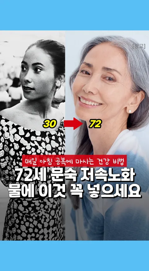018.문숙 이것?