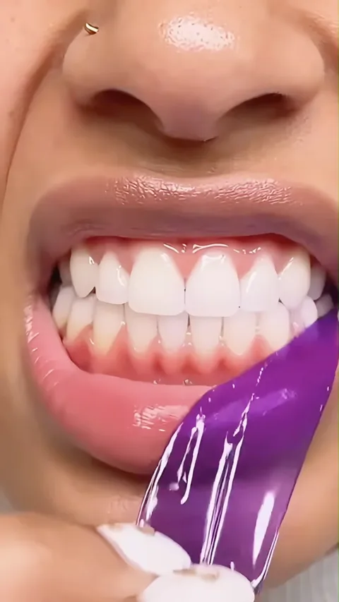 58 치과의사 몰래쓰는 다이소 품절템