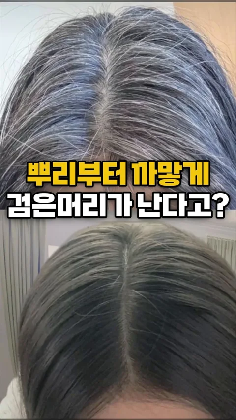 177. 뿌리부터 까맣게 검은머리가 난다고?!