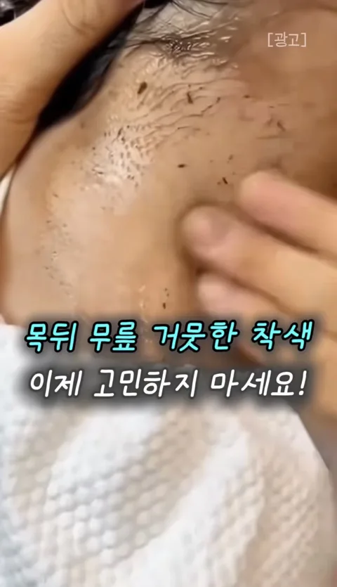54. 여름철 거뭇한 피부 착색과 블랙헤드 1분 만에 지우는 꿀팁