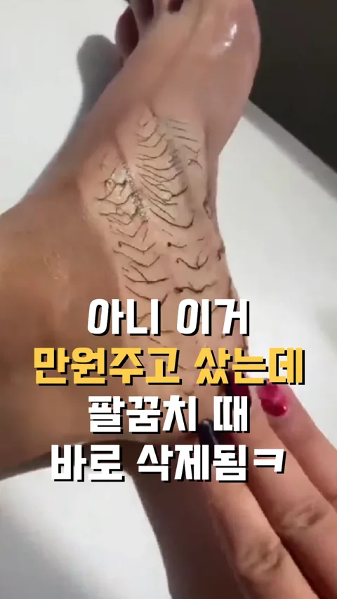 ♨️ 팔꿈치때 삭제템