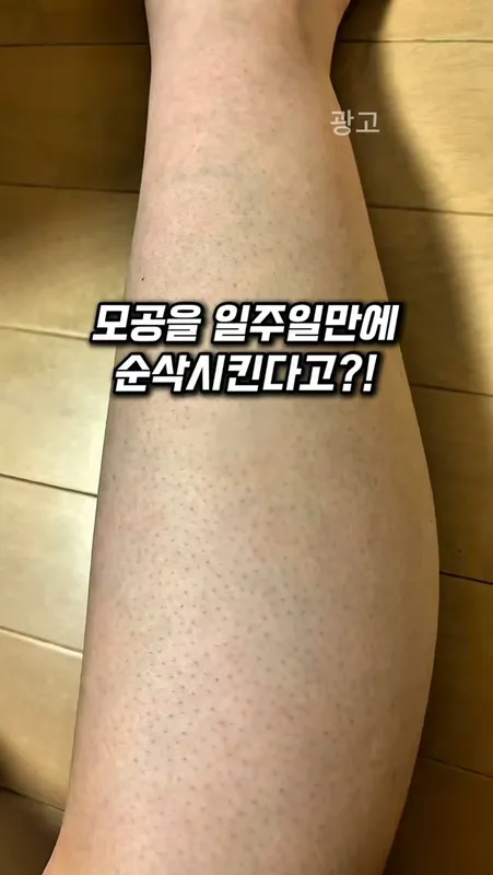 68. 일주일 순삭 모공크림