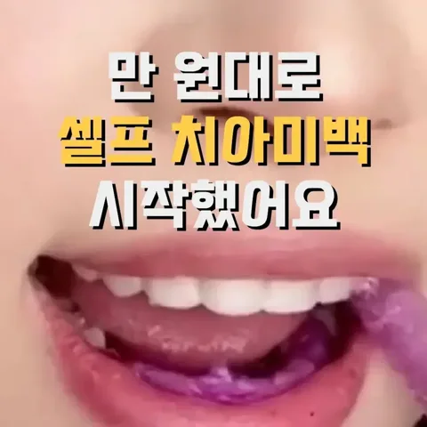 🦷 치아 미백템