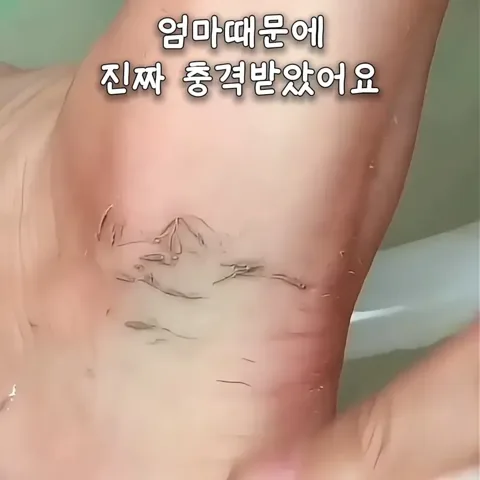 659. (클릭후 ‘659’검색)부드러운 요술때밀이