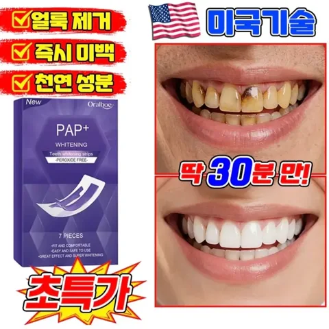 217. 치아미백 패치